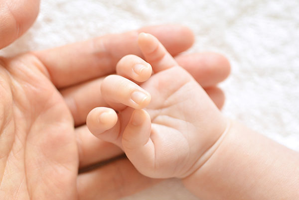 生まれつきのアザ　イメージ